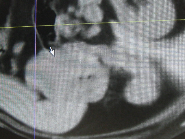 ファイル 1030-5.jpg