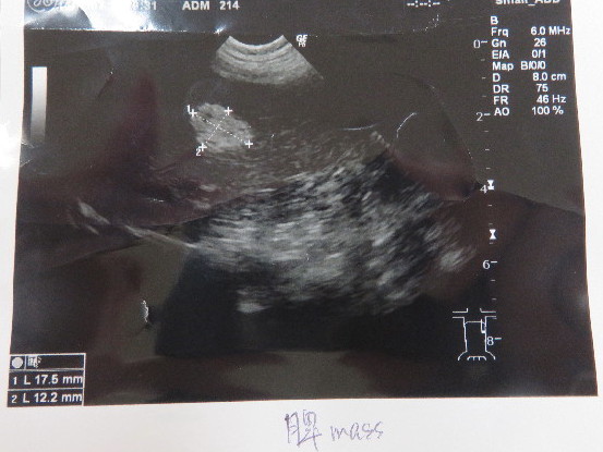 ファイル 5364-1.jpg