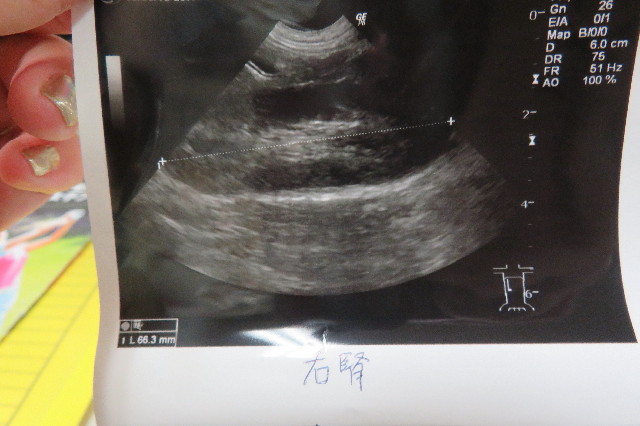 ファイル 6601-4.jpg