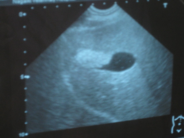 ファイル 707-2.jpg